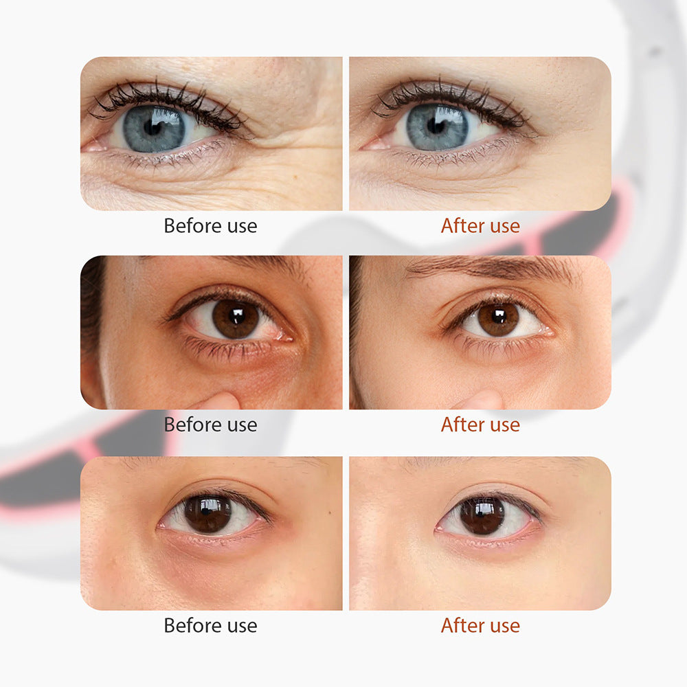 Micro Eye Massager & Red Light Therapy